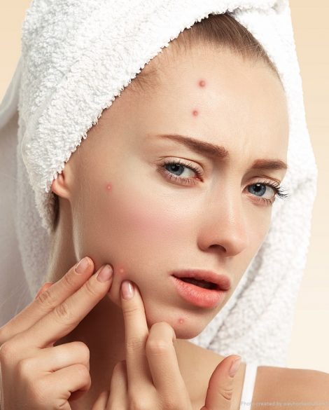 Close up isolated portrait of young woman squeezing pimple on her cheek in the bathroom. Cropped view of Caucasian female having skin problem, against blue wall background. Beauty and spa concept